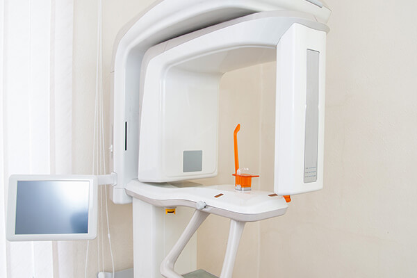 最新の歯科用CT（コーンビームCT）設備